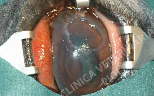 Cheratectomia profonda